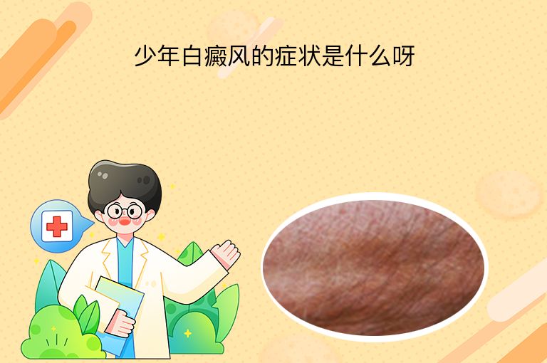 少年白癜风的症状是什么呀”