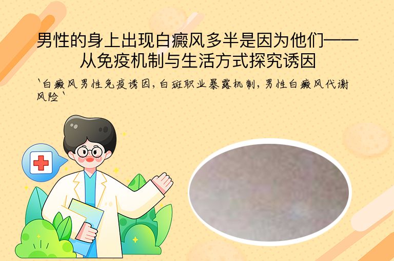 男性的身上出现白癜风多半是因为他们——从免疫机制与生活方式探究诱因