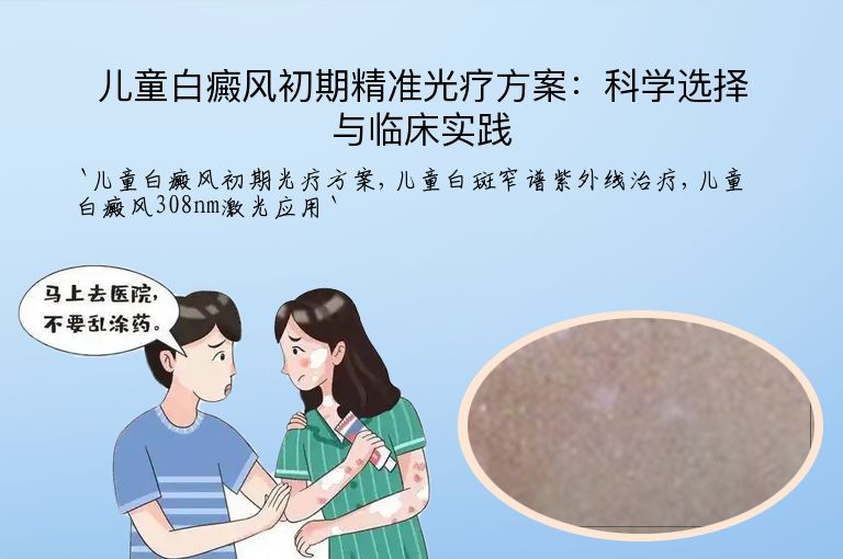 儿童白癜风初期精准光疗方案:科学选择与临床实践