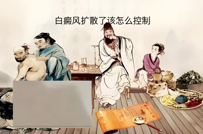https://www.bdfsjzyy.com/d/file/p/5e534e076071366a297edf003d807f3e.jpeg