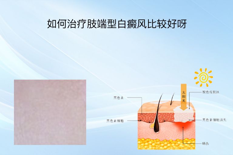 https://www.bdfsjzyy.com/d/file/p/a72e3fafe4aed942028ccc6a862fee5b.jpeg