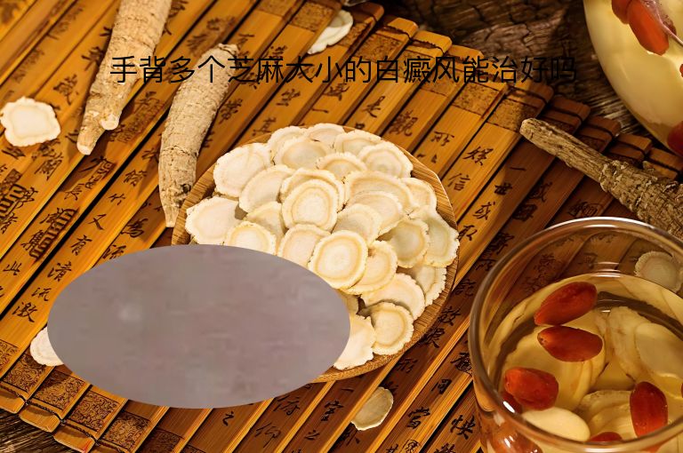 https://www.bdfsjzyy.com/d/file/p/e92616bb7d9213539ff2aead072a34e6.jpeg