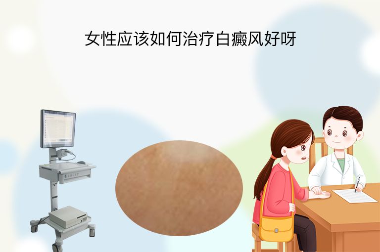 女性应该如何治疗白癜风好呀”