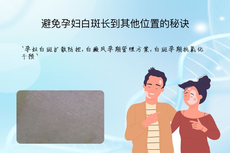 避免孕妇白斑长到其他位置的秘诀