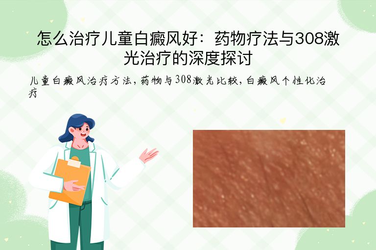 怎么治疗儿童白癜风好：药物疗法与308激光治疗的深度探讨”