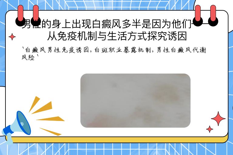 男性的身上出现白癜风多半是因为他们——从免疫机制与生活方式探究诱因