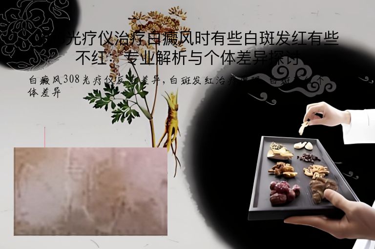 308光疗仪治疗白癜风时有些白斑发红有些不红：专业解析与个体差异探讨”