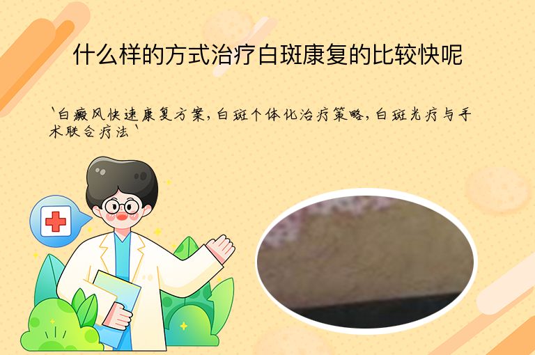 什么样的方式治疗白斑康复的比较快呢