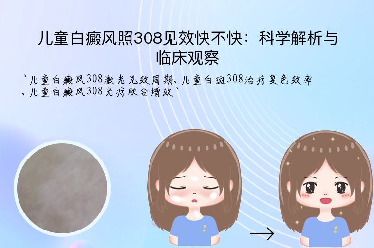 儿童白癜风照308见效快不快:科学解析与临床观察