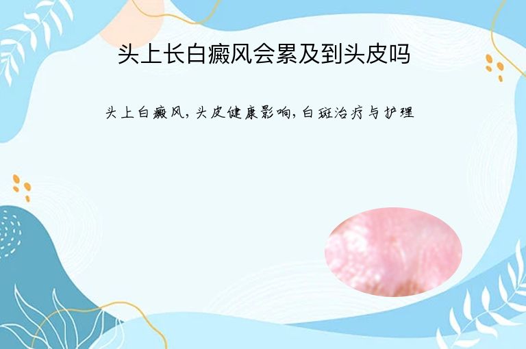 https://www.bdfsjzyy.com/d/file/p/9eaa57f51c056aabb8a640f04c358f9d.jpeg