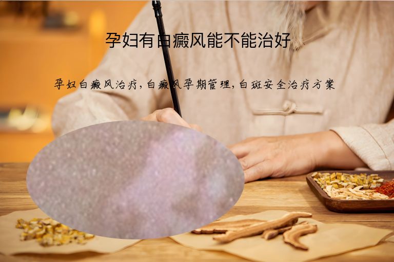 孕妇有白癜风能不能治好”