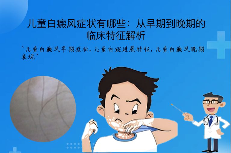 儿童白癜风症状有哪些：从早期到晚期的临床特征解析