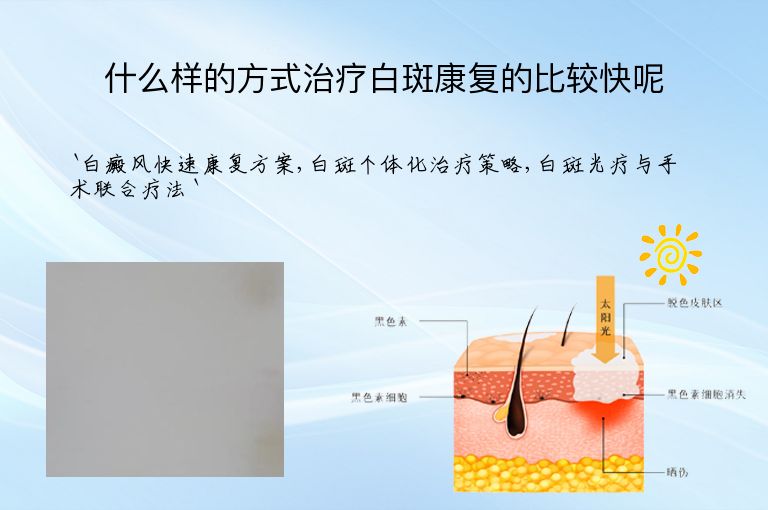 什么样的方式治疗白斑康复的比较快呢