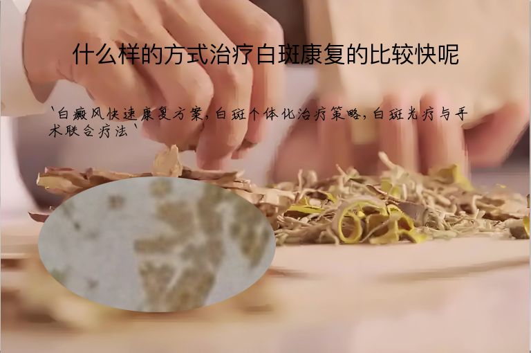 什么样的方式治疗白斑康复的比较快呢