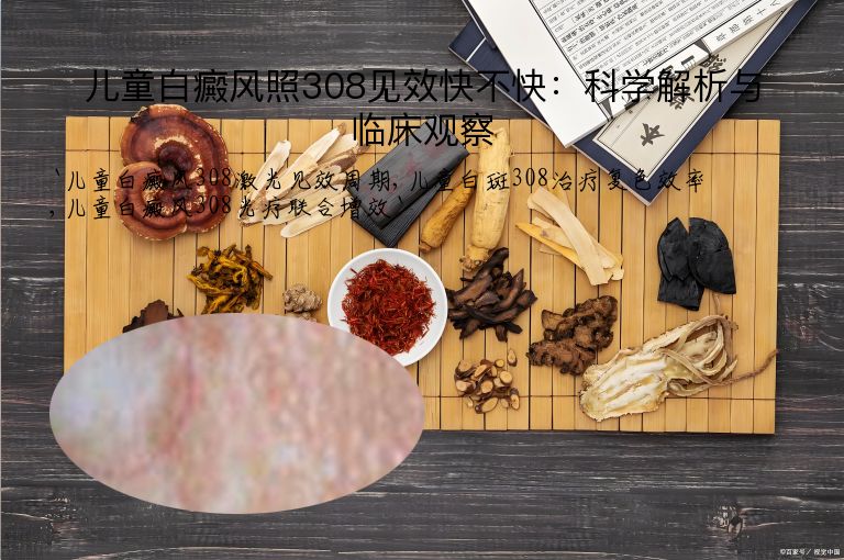 儿童白癜风照308见效快不快:科学解析与临床观察