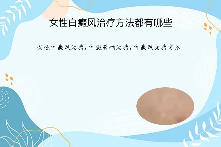 女性白癜风治疗方法都有哪些”