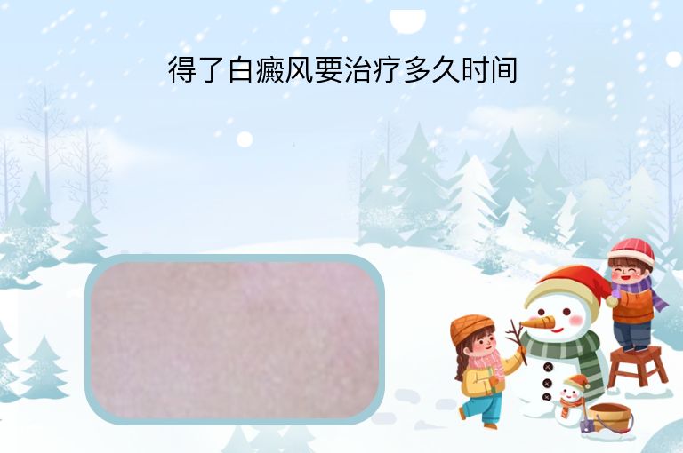 得了白癜风要治疗多久时间”