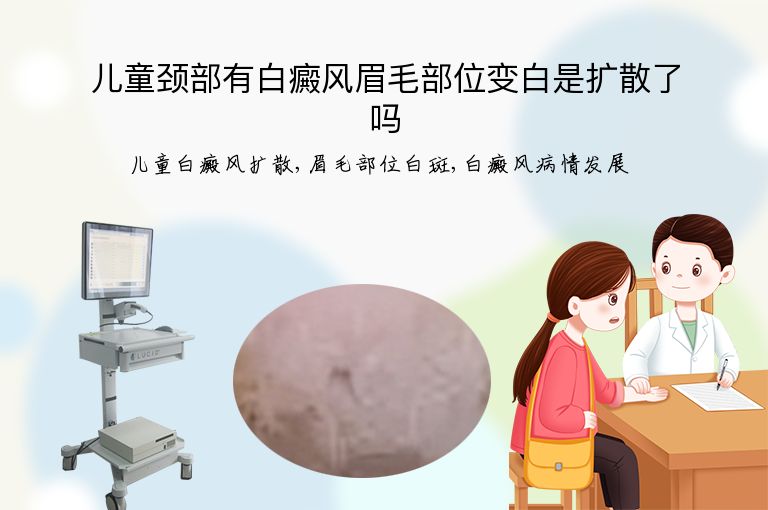 https://www.bdfsjzyy.com/d/file/p/fa0a2400e9fe7a520aaef5cc5e5ecd52.jpeg