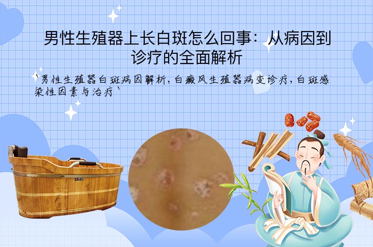 男性生殖器上长白斑怎么回事:从病因到诊疗的全面解析