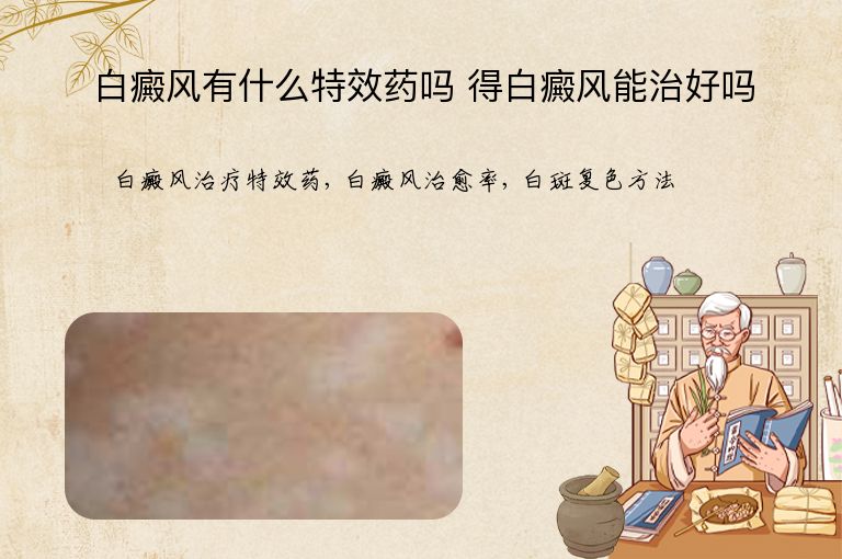 白癜风有什么特效药吗 得白癜风能治好吗”