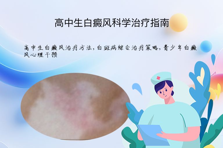 高中生白癜风科学治疗指南”