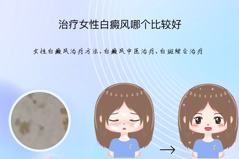 治疗女性白癜风哪个比较好”