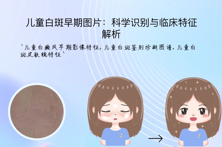 儿童白斑早期图片:科学识别与临床特征解析