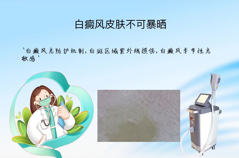 白癜风皮肤不可暴晒
