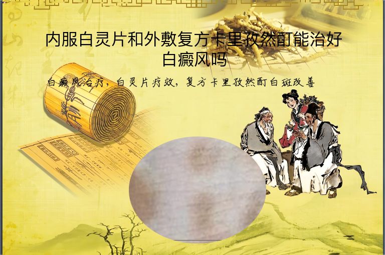 内服白灵片和外敷复方卡里孜然酊能治好白癜风吗”