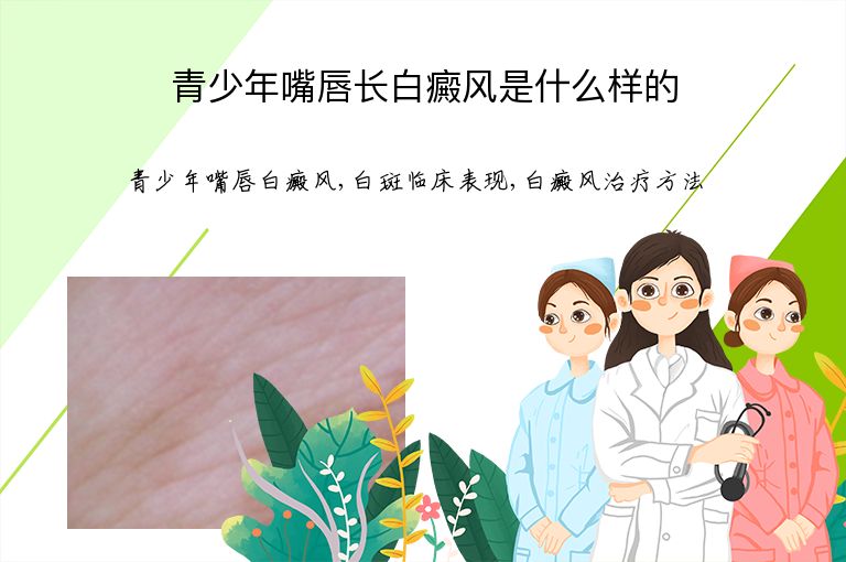 青少年嘴唇长白癜风是什么样的”