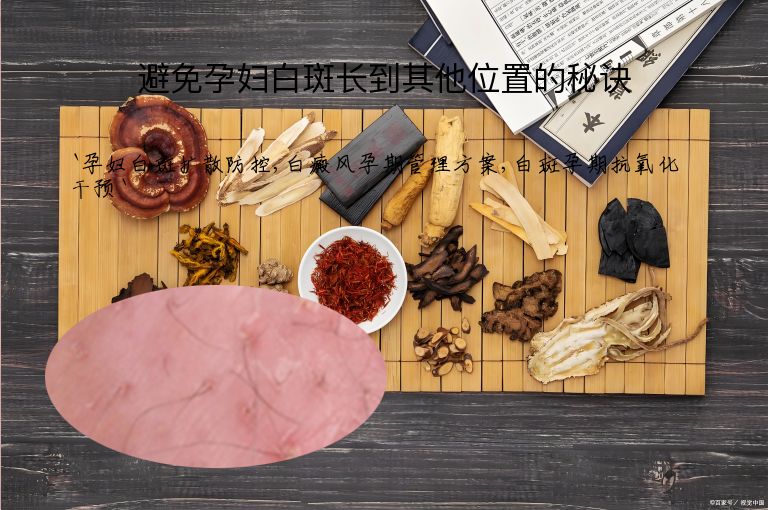 避免孕妇白斑长到其他位置的秘诀