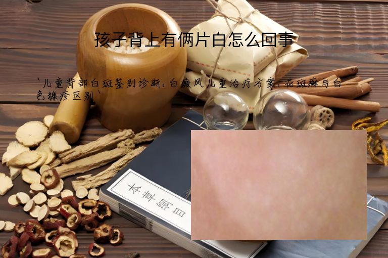 孩子背上有俩片白怎么回事