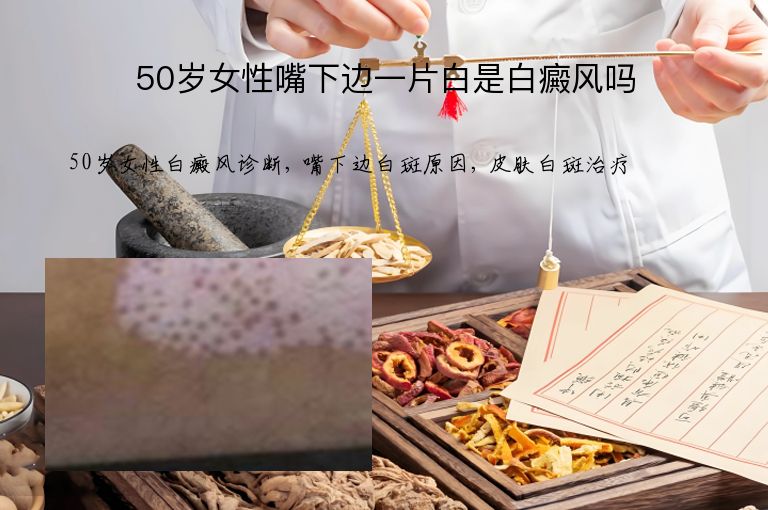50岁女性嘴下边一片白是白癜风吗”