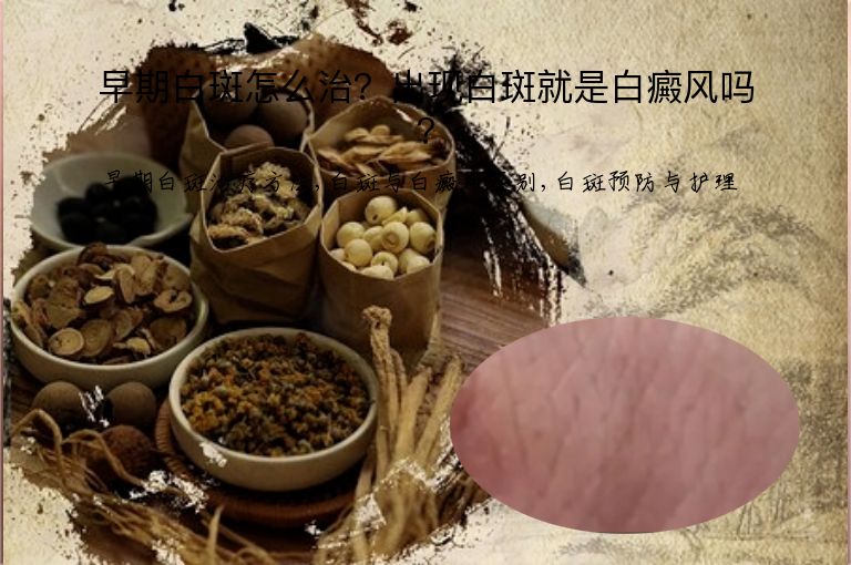 早期白斑怎么治？出现白斑就是白癜风吗？”