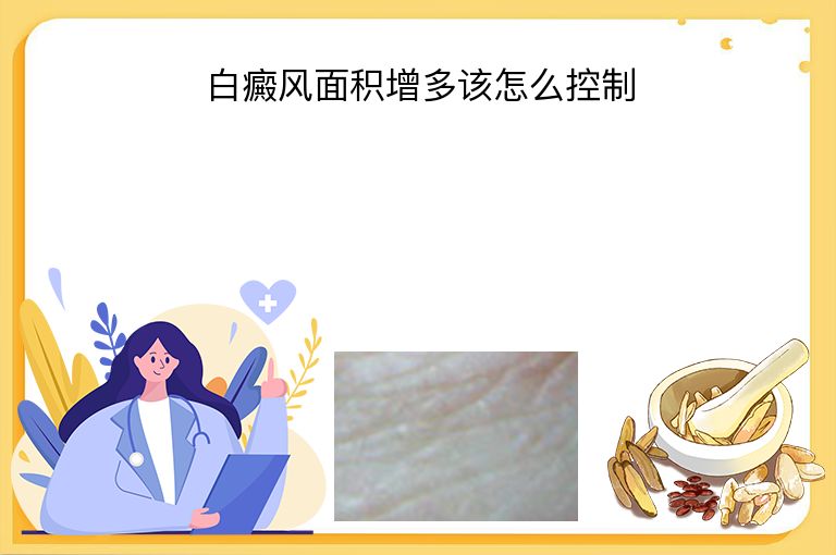 白癜风面积增多该怎么控制”