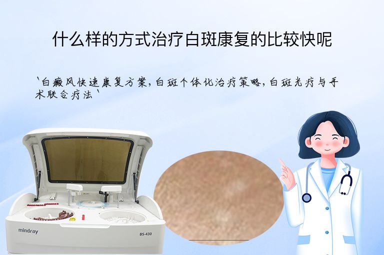 什么样的方式治疗白斑康复的比较快呢