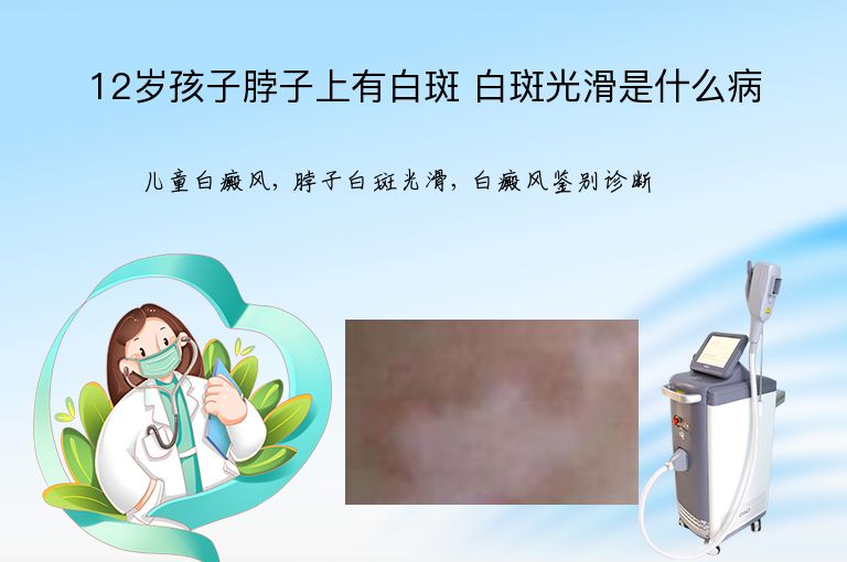 12岁孩子脖子上有白斑 白斑光滑是什么病”