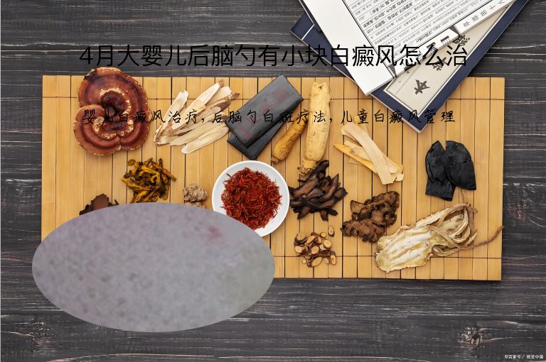 4月大婴儿后脑勺有小块白癜风怎么治”