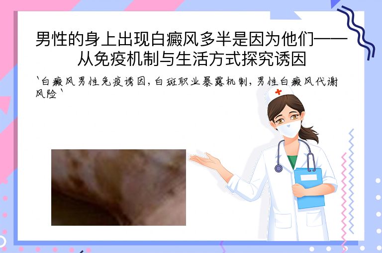 男性的身上出现白癜风多半是因为他们——从免疫机制与生活方式探究诱因