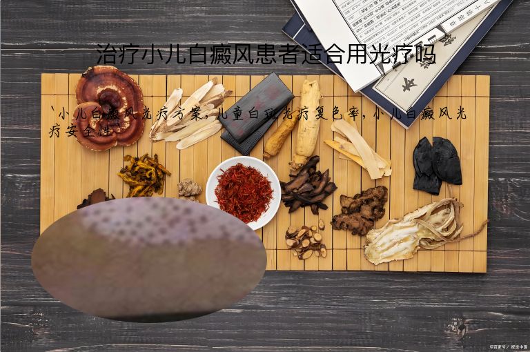 治疗小儿白癜风患者适合用光疗吗