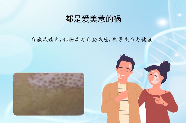 都是爱美惹的祸”