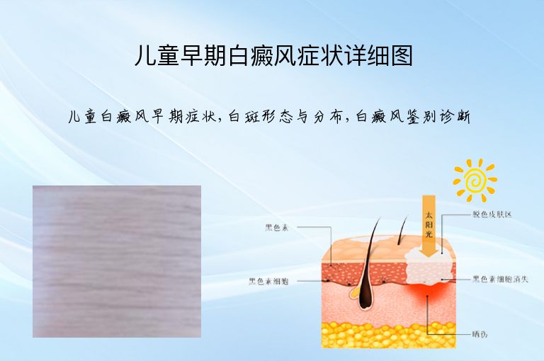 https://www.bdfsjzyy.com/d/file/p/3d9ea0cb645696d247353da0868faa5d.jpeg