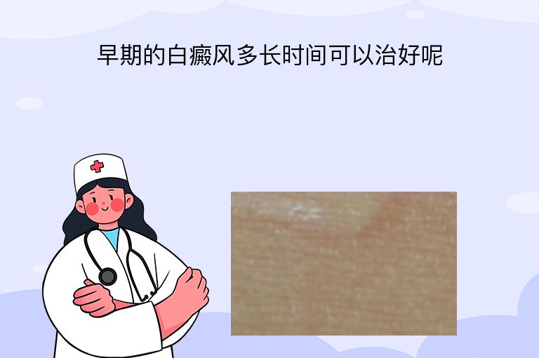 早期的白癜风多长时间可以治好呢”