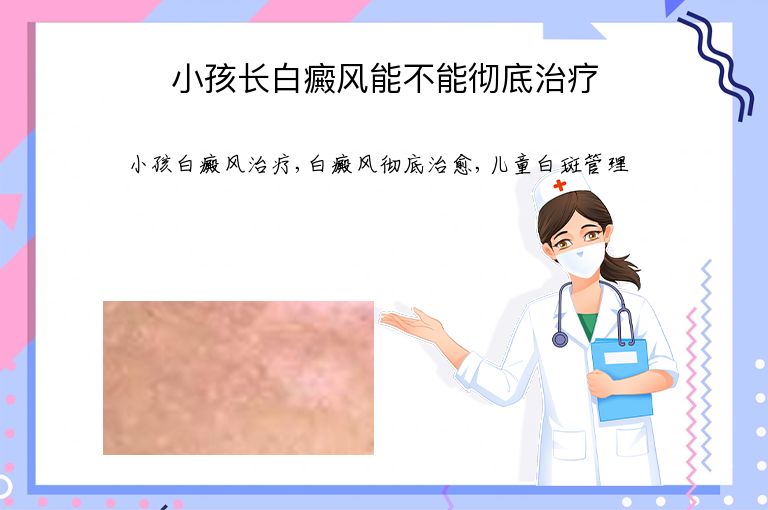 https://www.bdfsjzyy.com/d/file/p/7ceaea0cd5d383544ab50349a6e7d2db.jpeg