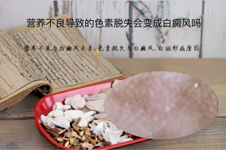 营养不良导致的色素脱失会变成白癜风吗”
