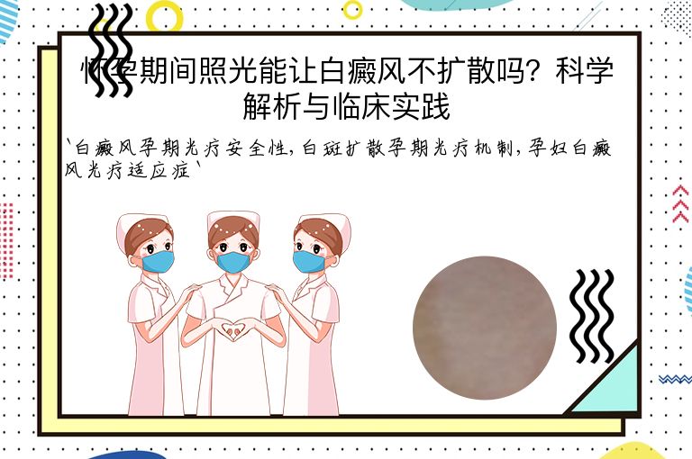 怀孕期间照光能让白癜风不扩散吗？科学解析与临床实践”