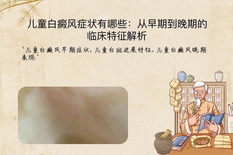 儿童白癜风症状有哪些:从早期到晚期的临床特征解析