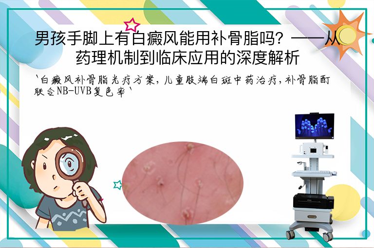 男孩手脚上有白癜风能用补骨脂吗?——从药理机制到临床应用的深度解析