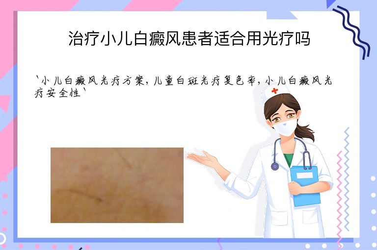 治疗小儿白癜风患者适合用光疗吗