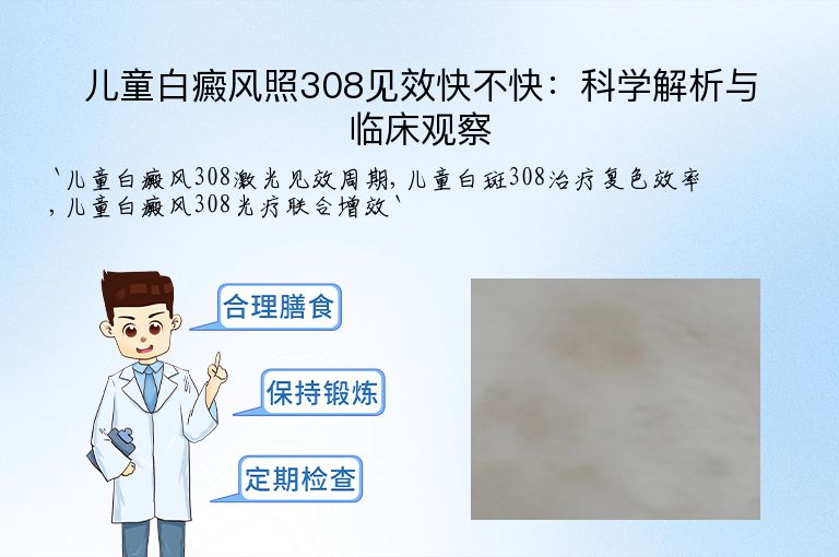 儿童白癜风照308见效快不快:科学解析与临床观察